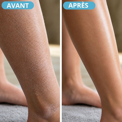 Lotion corporelle au rétinol
