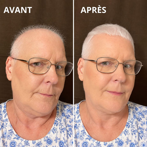 Ensemble shampoing et après-shampoing Solides à la Myrtille